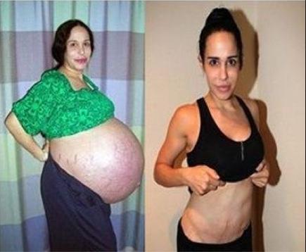 Octomom Nadya Suleman Une Femme Qui A Mis Au Monde Des Octuples Et Disait Les Detester A Voir