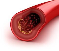 Cholestérol : tous les remèdes pour réduire l'excès de mauvais cholestérol et augmenter le bon cholestérol
