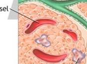 DIABÈTE type Bientôt vaccin thérapeutique? Science Translation Medicine