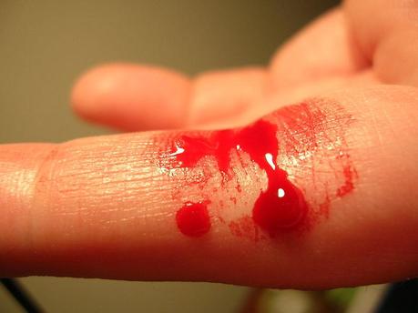 Blood art : en Grande-Bretagne, on fait de l’art avec son sang !