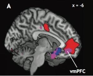 NEUROÉCONOMIE ou comment le cerveau fixe la valeur affective des choses – Journal of Neuroscience
