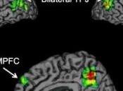 NEURO: Comment notre cerveau fait buzz Psychological Science