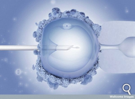 bébé né d’une fiv avec séquençage complet