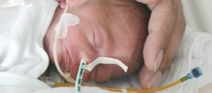 PRÉMATURITÉ: La curcumine du safran protège les poumons des bébés – American Journal of Physiology, Lung Cellular and Molecular Physiology
