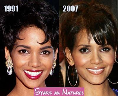 Halle Berry chirurgie