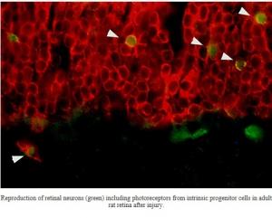 DMLA: Régénération rétinienne par cellules souches iPS  – Riken