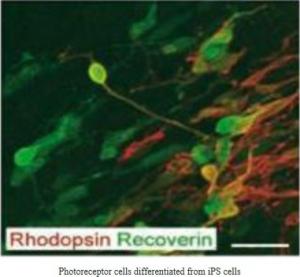 DMLA: Régénération rétinienne par cellules souches iPS  – Riken