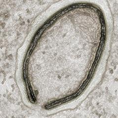 PANDORAVIRUS: La découverte d'une nouvelle forme de vie? – Science (AAAS)