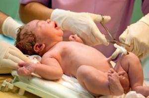 ANÉMIE: Le clampage tardif du cordon augmente le taux de fer chez les bébés – The Cochrane Library