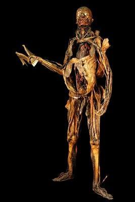 Écorché vif disent-ils Myologie+et+splanchnologie+de+l%2527homme.jpg