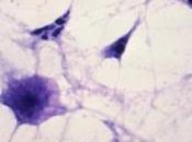 DIFFICILE: Pouvoir prévoir risque décès Infectious Diseases