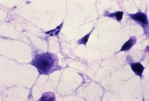 C. DIFFICILE: Pouvoir prévoir le risque de décès – BMC Infectious Diseases