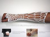 impressions plus folles