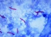 TUBERCULOSE: Décryptage génétique multi-résistances Nature Genetics