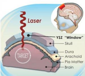 NEURO: Un hublot pour voir dans le cerveau – Nanomedicine: Nanotechnology, Biology and Medicine