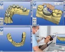 Les imprimantes 3D révolutionnent la dentisterie 
