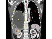 Peut-on guérir cancer l'industrie médicale vous permettait, serait possible, mais...