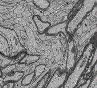 Le SOMMEIL, réparateur de la myéline du cerveau  – The Journal of Neuroscience