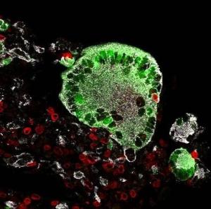 VACCIN anti-VIH: Un nouveau pas vers l'espoir – Nature