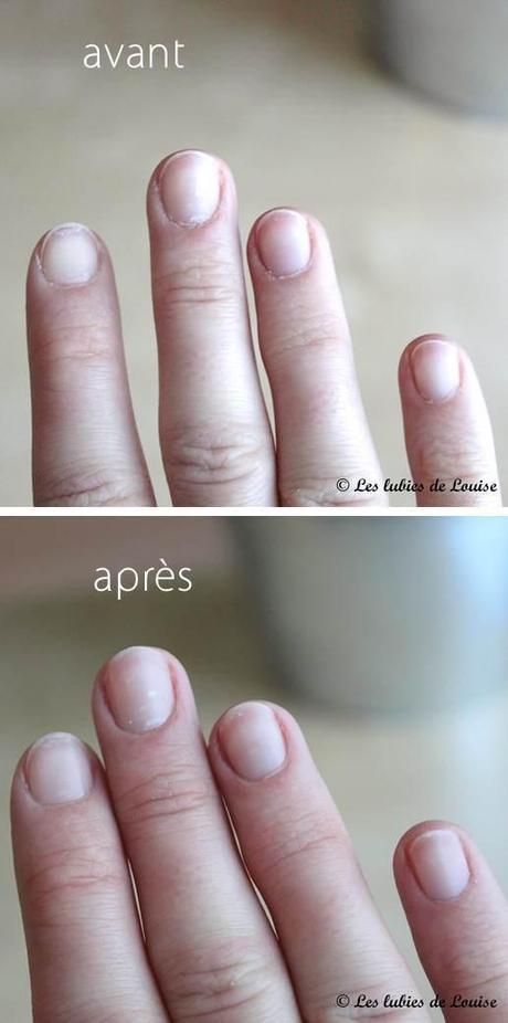 La Petite Huile Magique Pour Les Ongles Ecrinal Paperblog
