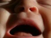 TROUBLES DÉVELOPPEMENT: s'entendent dans pleurs bébé Journal Speech, Language Hearing Research