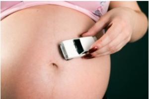POLLUTION: Exposition prénatale et troubles de comportement chez l'enfant  – Pediatrics