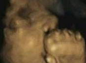 DÉVELOPPEMENT: foetus s'initie toucher dans l'utérus mère Developmental Psychobiology