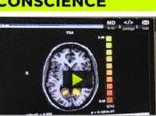 COMA: recherche conscience Réseau