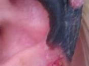 ALERTE INFO. Italie: araignée mord détruit entièrement l’oreille d’une fille