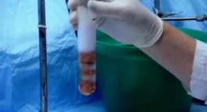 VIH: Comment l'infection peut mener au trouble cognitif – The Journal of Neuroscience