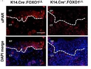 PLAIES: FOX01, la molécule qui accélère la cicatrisation  – The Journal of Cell Biology