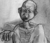 L'aide à l'Afrique et l'affaiblissement des capacités locales