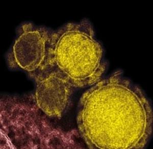 MERS-CoV: Le chameau toujours suspecté de transmettre le virus à l'homme – OMS