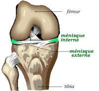 6 mois de galère, un mauvais diagnostic ?