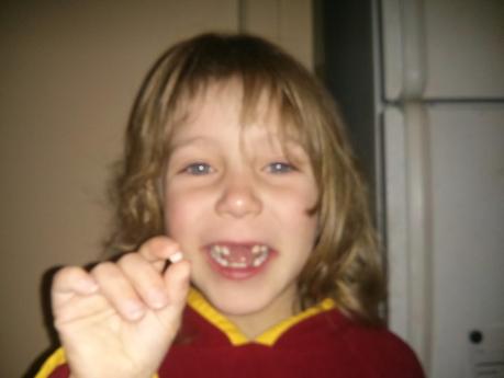 Les dents de bébé...