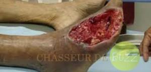 Krokodil débarque en France krokodil