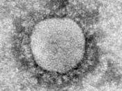 Coronavirus syndrome respiratoire aigu sévère Moyen Orient chez chameaux étude d’investigation grande amplitude