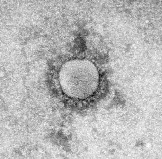 Coronavirus du syndrome respiratoire aigu sévère du Moyen Orient chez les chameaux : étude d’investigation de grande amplitude