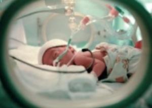 PRÉMATURITÉ: Diagnostiquer très tôt les troubles du développement – Radiology