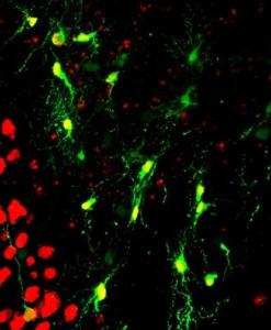 ALZHEIMER: Et si l'on reprogrammait les neurones? – Cell Stem Cell