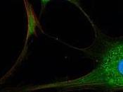 SCHIZOPHRÉNIE: Relancer l'autophagie cérébrale pour nettoyer cerveau Molecular Psychiatry