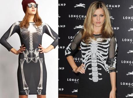 The skeleton trend