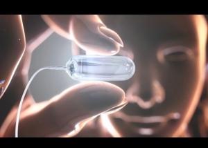 PERTE de POIDS: Obalon, la petite pilule qui se gonfle en ballon gastrique  – NHS