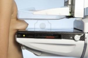 CANCER du SEIN: Le dépistage par mammographie doit-il être systématique ou opportuniste ? – Swiss Medical Board