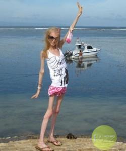 Il faut souffrir pour être horrible ! anorexie7