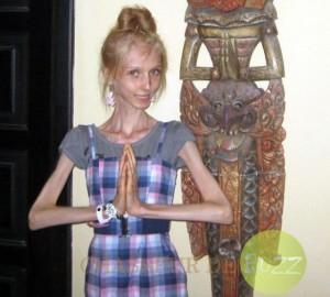 Il faut souffrir pour être horrible ! anorexie