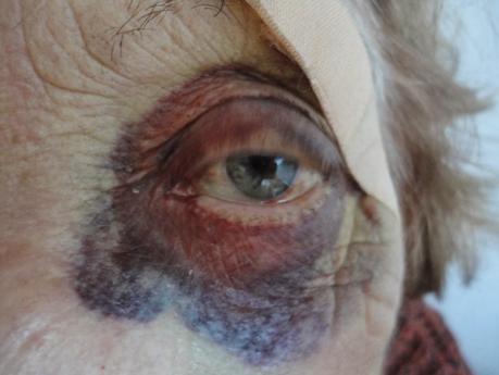 la pomme et l'escargot