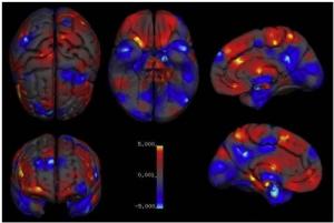 NEURO: Hommes ou femmes, qui a le cerveau le plus gros? – Neuroscience and Biobehavioral Reviews