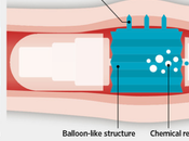 Maladies chroniques injections grâce pilule robotique