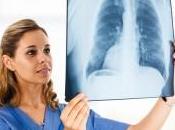 curcumine cancer poumon